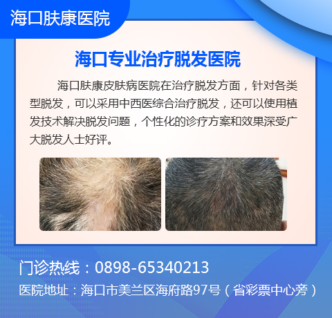发际线后移的真正原因是什么,有什么好的解决方法吗?