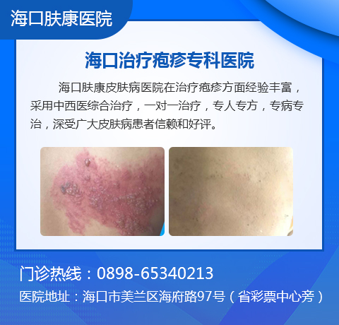 带状疱疹,为什么痛到怀疑人生!