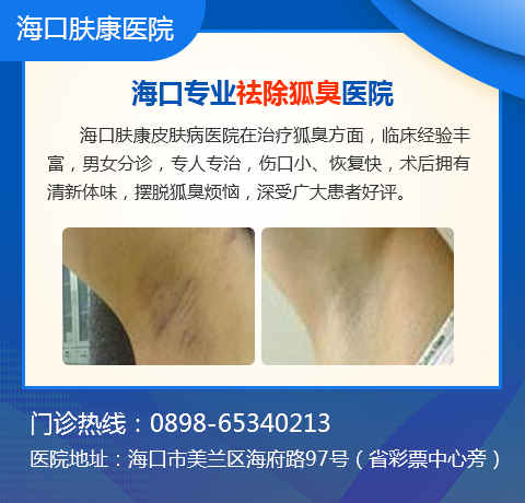 海口美兰哪家医院做腋臭好